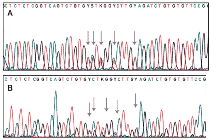 chromatogram